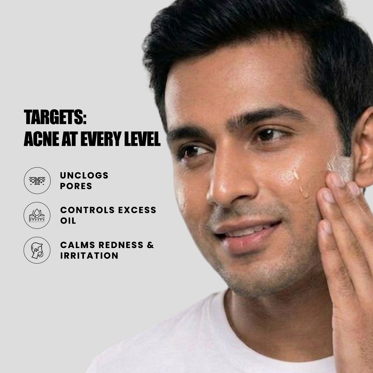 Anti-Acne Face Serum | Pore & Oil Control